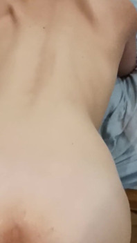 Anal domalma