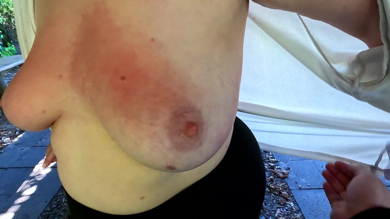 Bouncy Tits Action: Red and Swollen Tits at Public Bbq Place