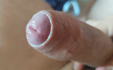 DaddyDoted: Dilation of the Corpus Cavernosum Exposes Spongy Foreskin.