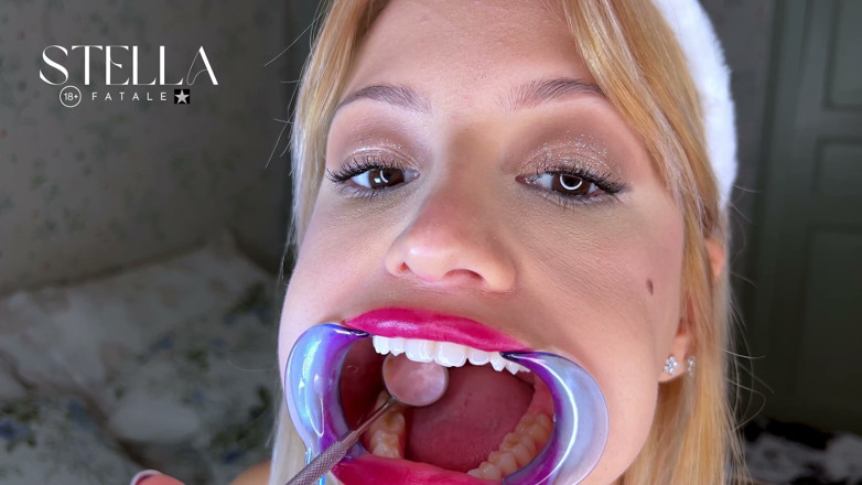Stellafatale: Mouth Retractor Teeth Examination