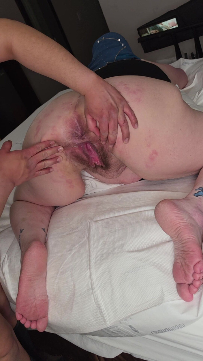 CrippleFreak4U: हिजाबी अपंग दोनों कोणों से कुत्ते शैली की चुदाई