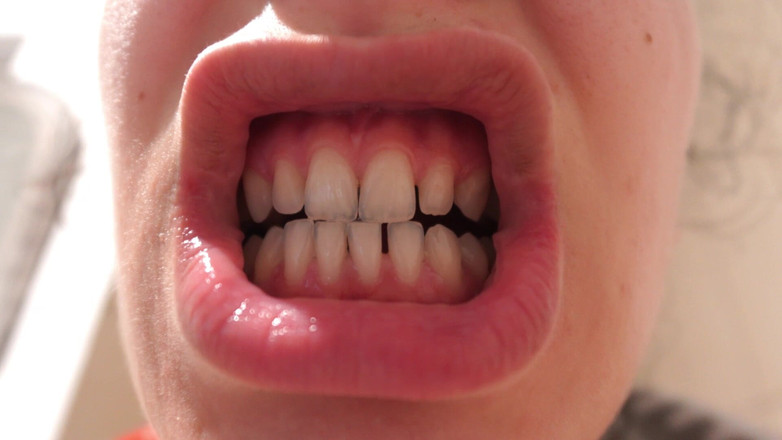 AmayaMori: Moje indická nevlastní sestra si čistí zuby a pak dělá čtvercovou pusu