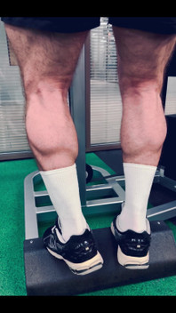 My Legs
