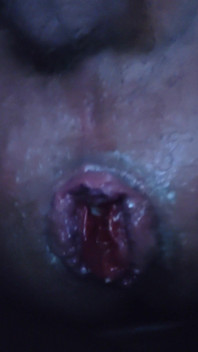 Playing with My Rosebud'd Pig Hole