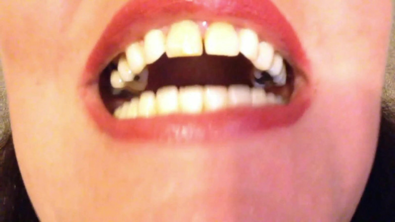 Lily Lipstixxx: Mouth inspection - Be careful, I bite!