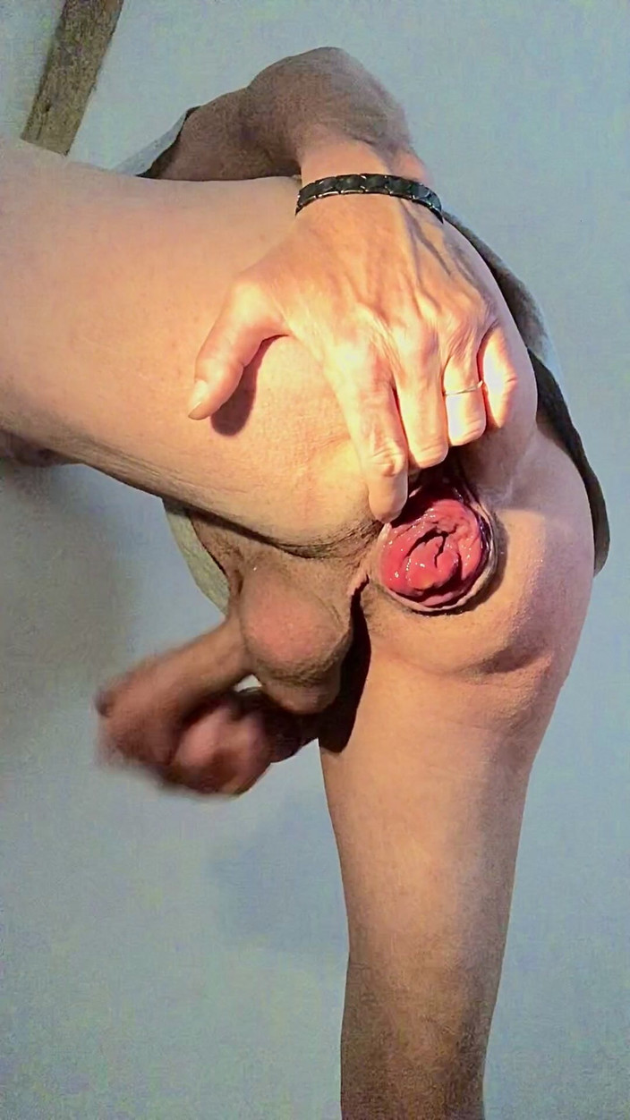 Jardinsecret346: Empurrar prolapso anal