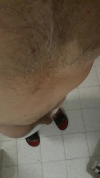 wernerlisaamityville: Werner