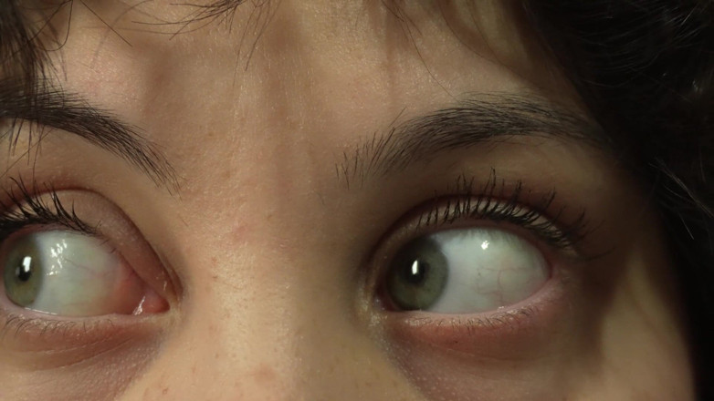 AmayaMori: Come Look Into My Eyes Because I Have an Eye...