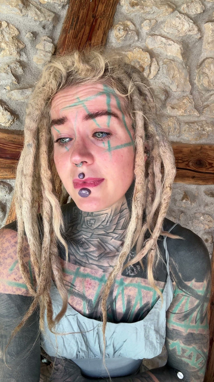 Anuskatzz: I Got New Boobs and an Upper Blephoplasty. in This...