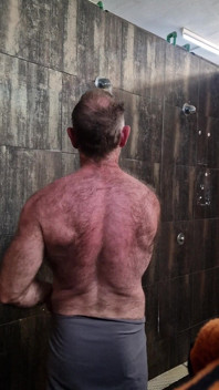 Hairy Back Strip