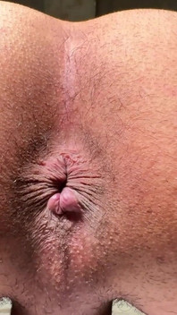 Asshole in Your Face