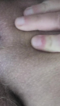 Dirty Anus