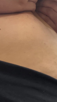 J Cup Cleavage Cam 2