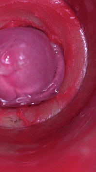 Camera Inside Pussy: Powerfull Cum in Pussy! Best Internal Asmr in 4K More Sperm