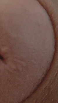 Closeup Menakjubkan Dari Lubang yang Melebar!!