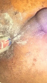 Iyke740 Part 1 of My Hairy Asshole Disvirgined