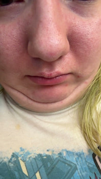 Chin Faces