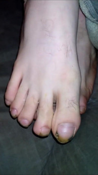 Foot Fancies
