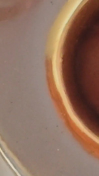 Boy Close up Tight Uncircumcised Glans Excited