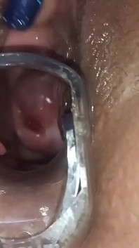 Masturbation with womb view and medical speculum, close up of my pussy