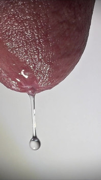 Penis Tropft