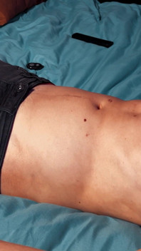Belly Roll