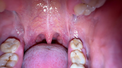 Hottie goddess: Ústa tajemství: tlustý bílý lak na mém jazyku