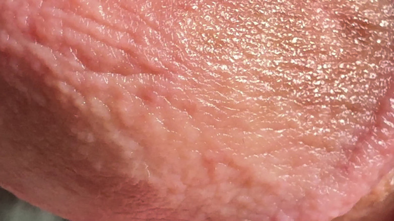 Leonardo-1974: Jari di Penis. Lubang di Penis Penetration.