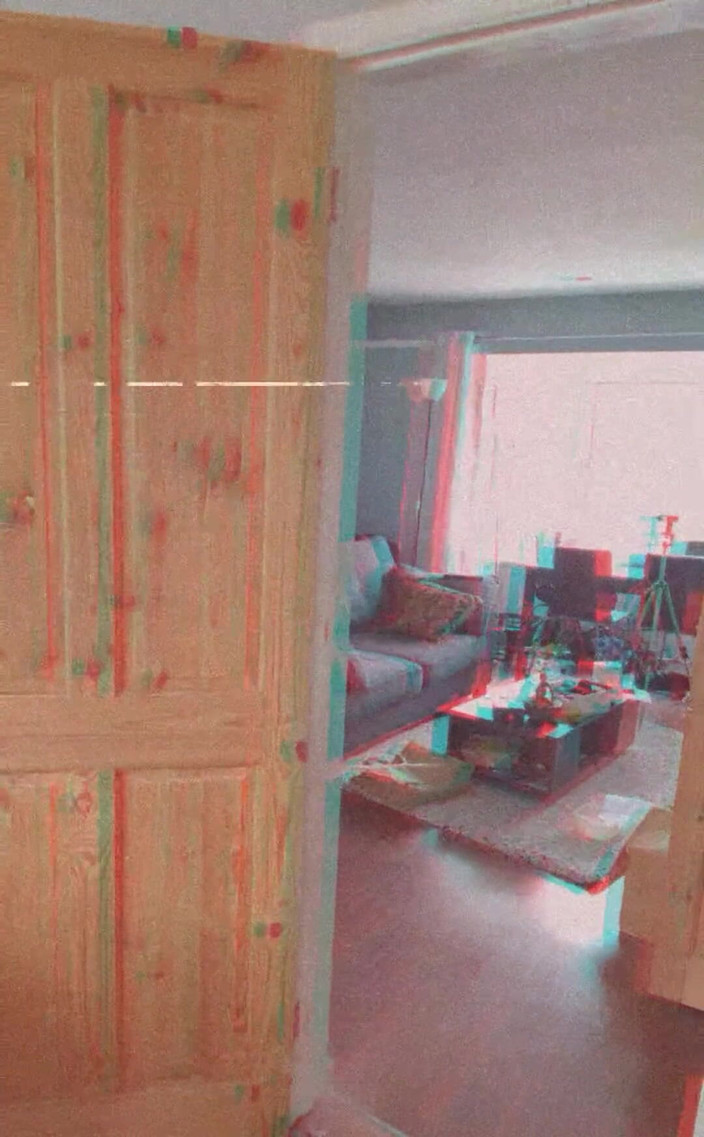 Amadeus: Ich denke, ich mag jetzt blau, lässt beule groß aussehen