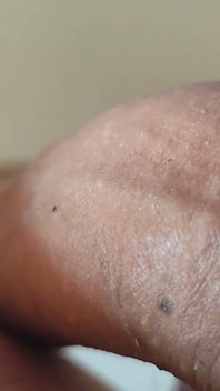 Strange Lumpy Cock with a Gigantic Head.