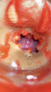 Kamera dalam sudut pandangan pertama Cervix dubur, dicuckold kecil oleh 'pasangan gergasi', pancutan mani dalam dubur dan creampie - Asmr