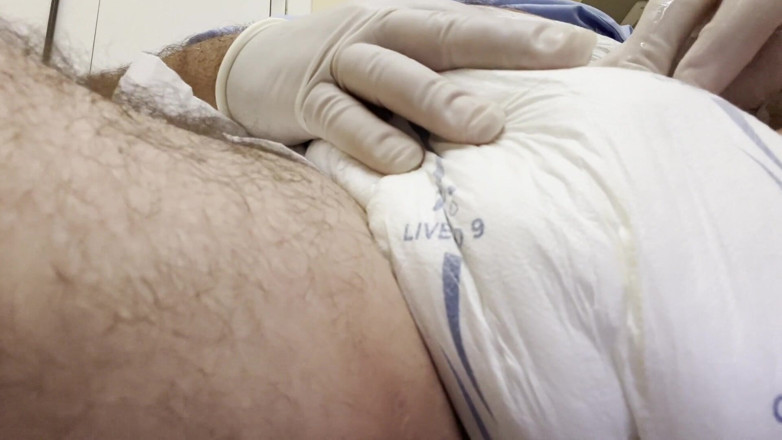 Diapers_MD: Inserimento di catetere ch20 di erezione.