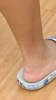 Alla linea ammira i piedi come cure