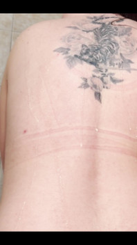 My Armpit Hairs Started Growing Back in Just One Day.