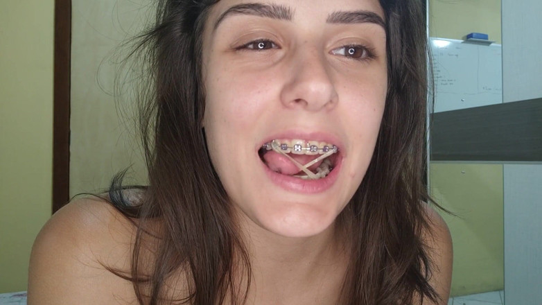 Shamelesscouple: Ejaculare pe aparat dentar fluture