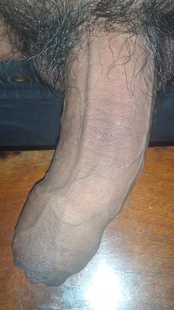 ElementalesLeches: Ereção ao vivo