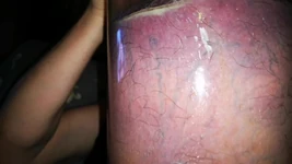 Ik probeer eruit te komen, maar zit vast in mijn buis