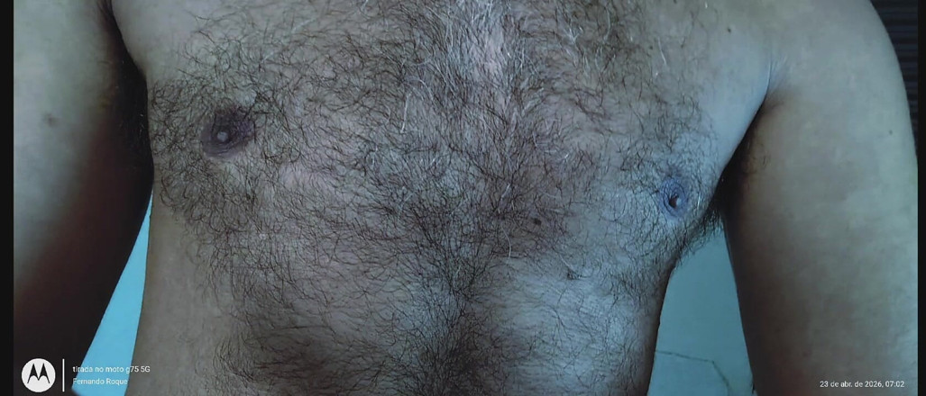 Rock F hairy: nee subah
