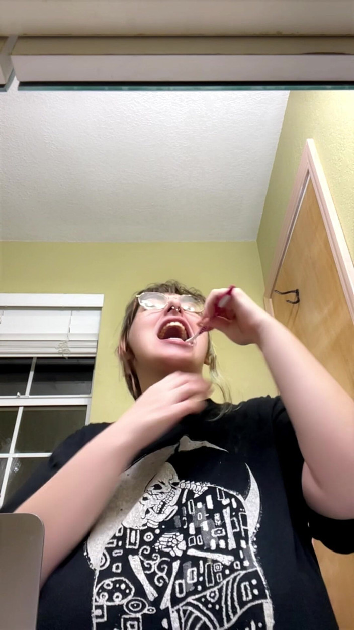 Mushroombitchx: Berus gigi saya