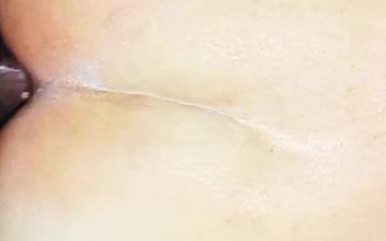 Anal Sex Hurts Me More