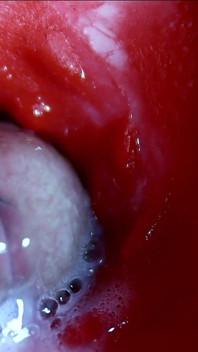 Muito perto enormes fluxos de esperma em um buraco doce Asmr wet squelches