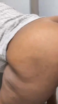 大黑狗式深肛门射液