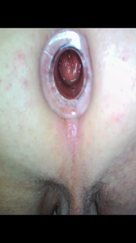 Anal Gape Extreme Close up Views