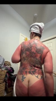 These are going to be some pretty intense tan lines once the red goes away