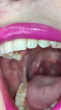 Mouth Tour