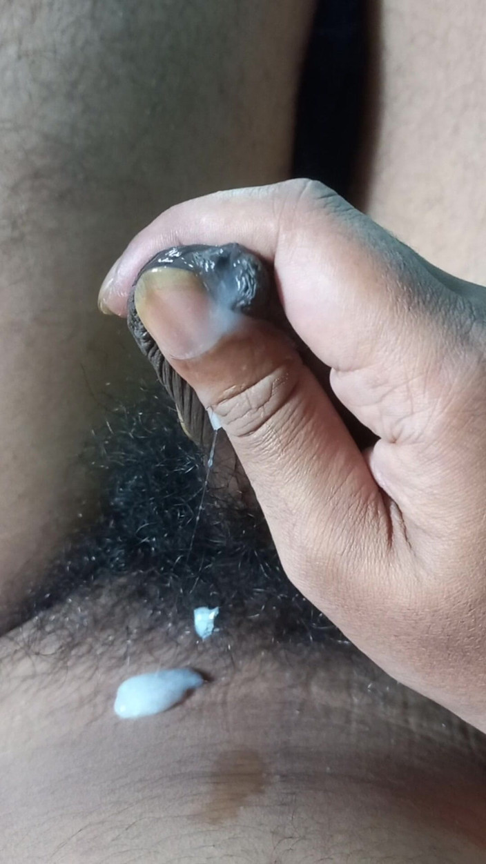 Lustyizlife: Těsná předkožka phimosis čůrák zblízka kape pre sperma, dokud se neudělá