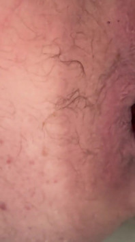 Anal Gape