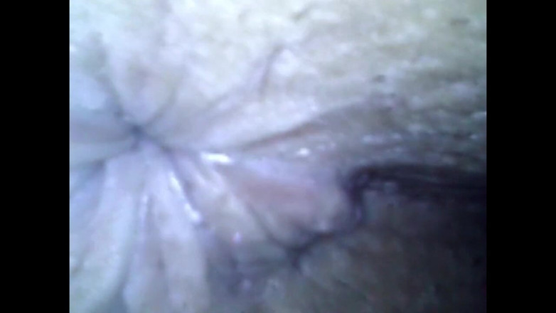Idmir Sugary: Endoscoop details - gat ballen pik voorhuid buik tepels mond sperma
