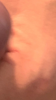 The Doctor Prepares His Very Hard Cock Before Sticking It in My Ass