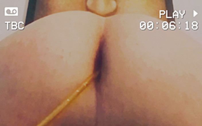 LymalX: お尻の金